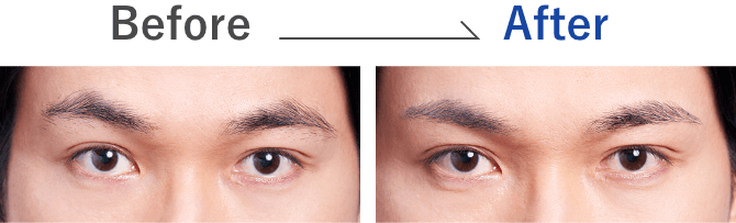 Before／After
